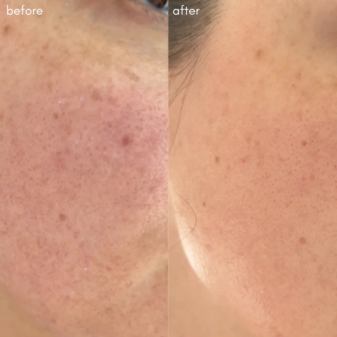 Maya Chia SUPER LIFT Concentrated Vitamin C-More Serum