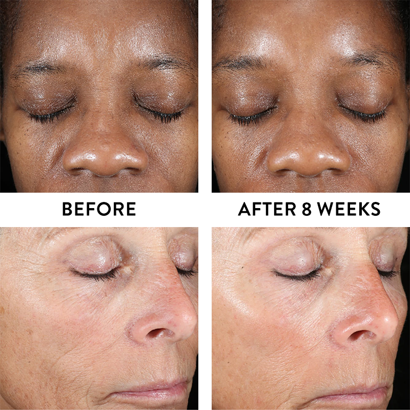 iS Clinical Active Peel System