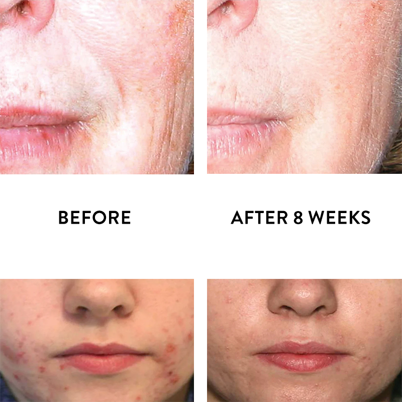 iS Clinical Active Serum