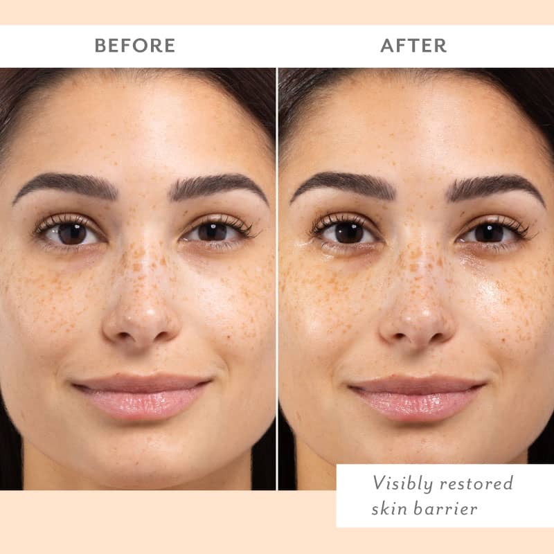 Patchology Skin Remedy Calm & Protect Mist