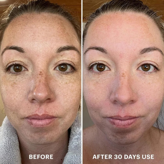 Glo Skin Beauty Bio-Renew EGF Cream