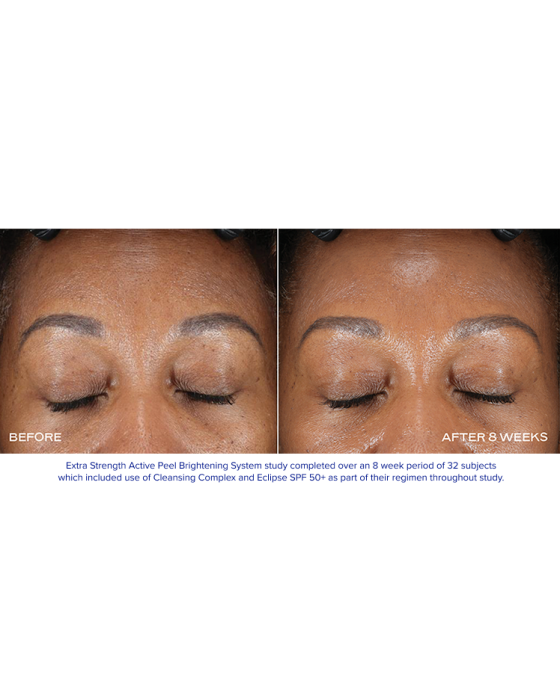 iS Clinical Extra Strength Active Peel Brightening System