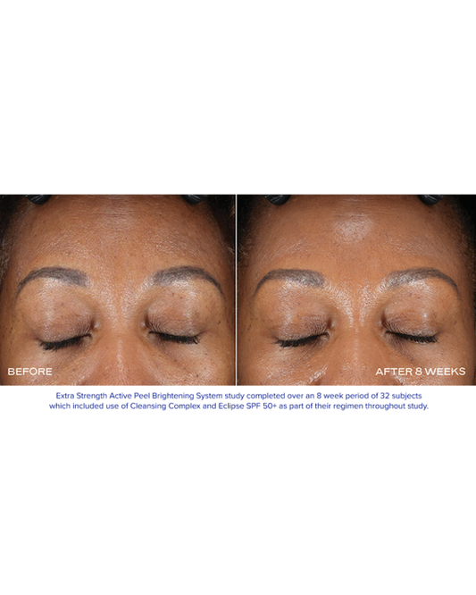 iS Clinical Extra Strength Active Peel Brightening System