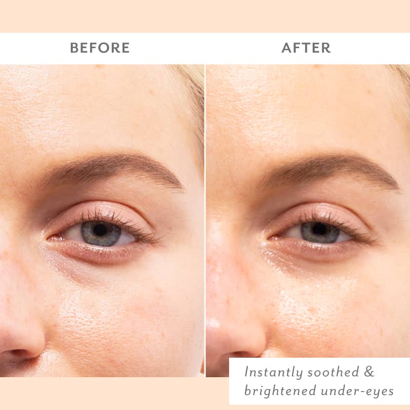 Patchology Skin Remedy Soothing Eye Gels