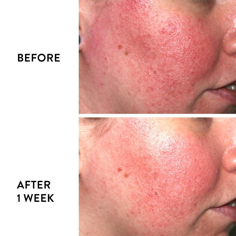 iS Clinical Pro-Heal Serum Advance+