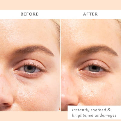 Patchology Skin Remedy Soothing Eye Gels
